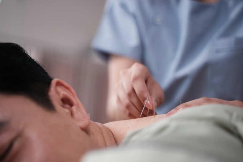 Sessão de acupuntura na nuca de um doente